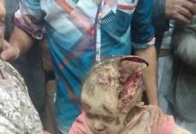 Yemen’s Health Ministry Condemns Saudi Massacre In Amran