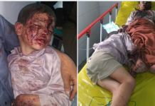 Citizen killed in Hodeidah, 4 injured in Sana’a by explosion of bombs left by aggression