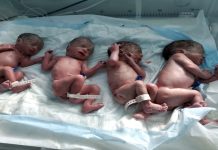 Yemeni woman gives birth to 4 babies in Sana’a