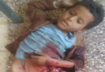 Human Rights Office condemns murdering of 8-year-old child in Taiz