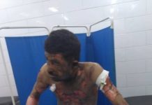 A young man sets his body on fire after the STC forces Destroyed his shop
