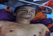 Gunmen assassinate son of pro-aggrssion military commander in Dhalea