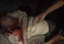 Death toll from US-British aggression on Hodeidah rises to 16