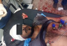 One killed and others wounded in clashes in Aden