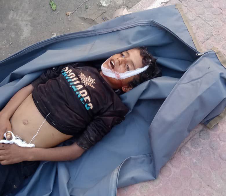 Child Killed In Mercenary Attack In Taiz Province