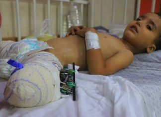 WHO: More than 43,000 injured in Gaza