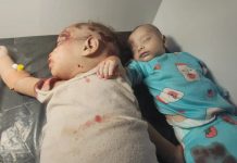 Six Citizens martyred, others injured in Saudi enemy airstrikes on Al-Mokha in Taiz